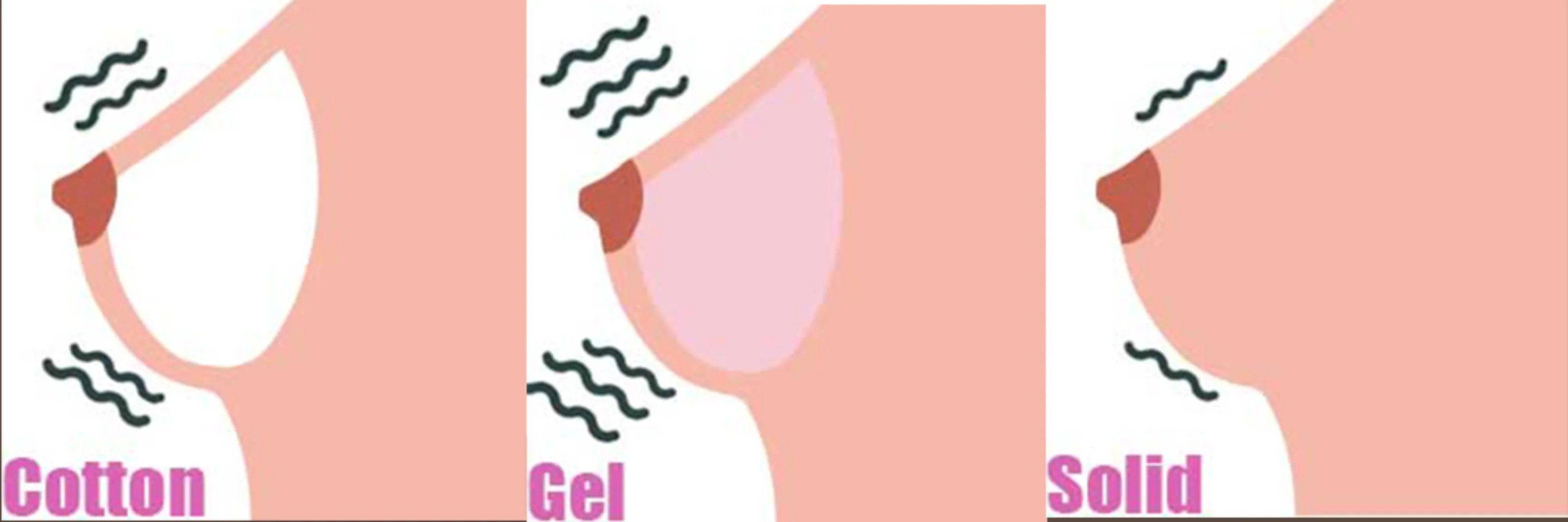 breast type